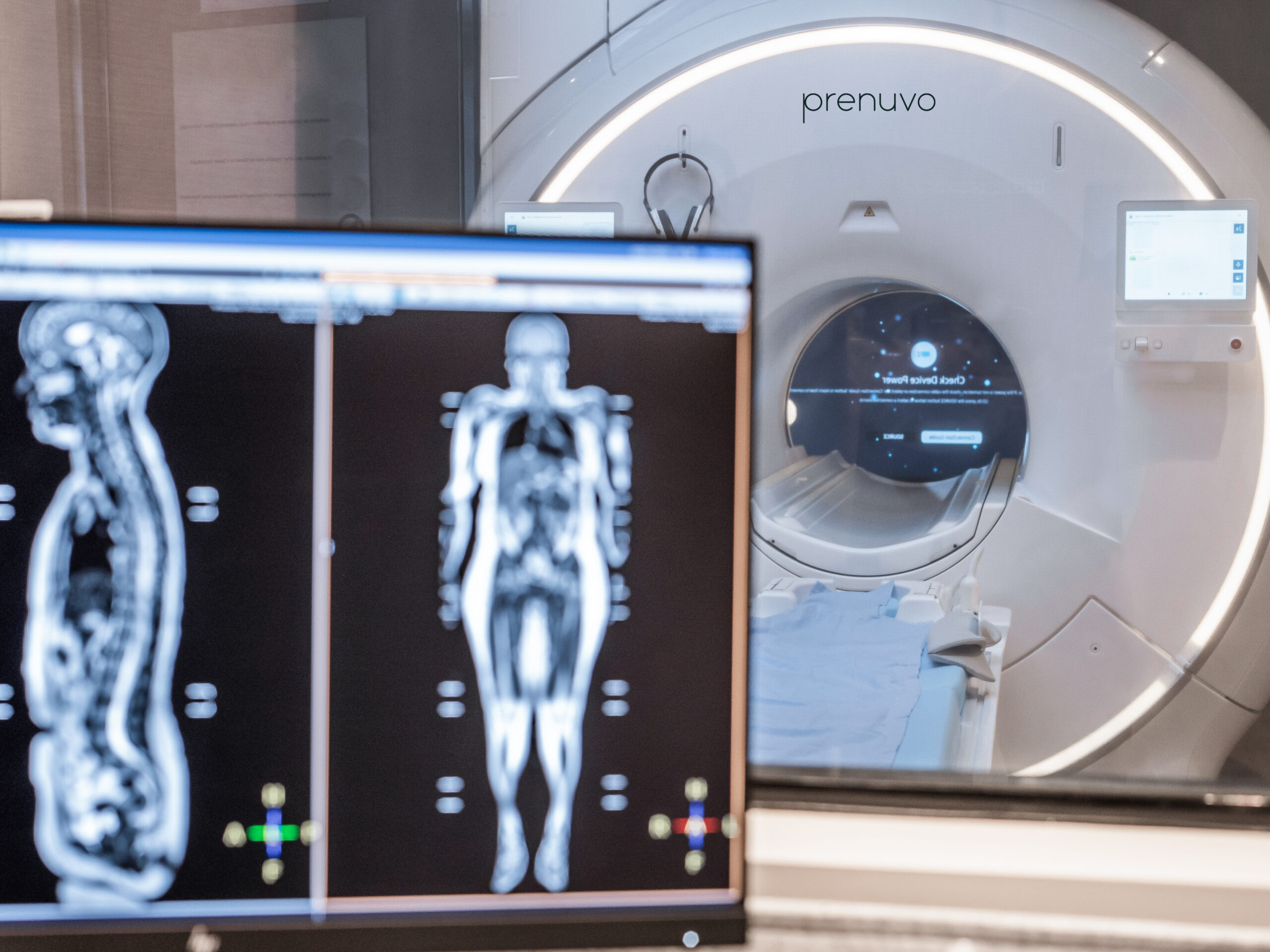 Image of Prenuvo whole-body MRI-scan machine and results.